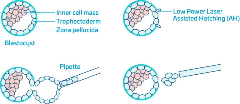 Biopsy & PGT | Superior A.R.T.