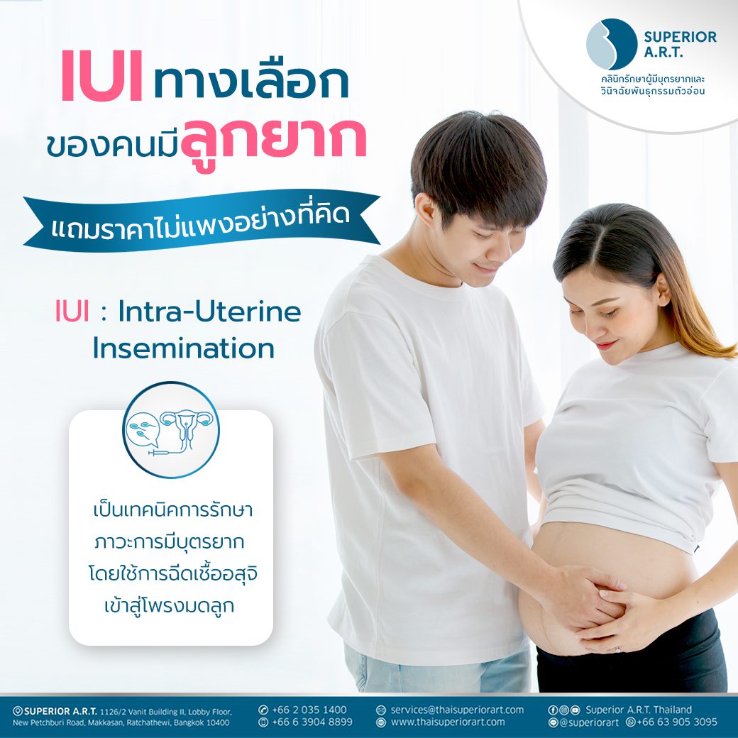 IUI อีกทางเลือกของคนมีลูกยาก