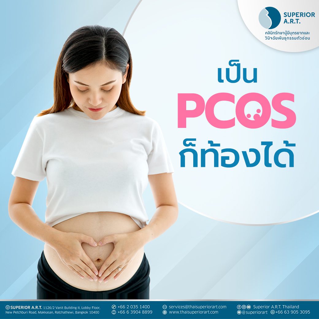 ภาวะ PCOS หรือโรคถุงน้ำรังไข่หลายใบ ที่เป็นอีกหนึ่งสาเหตุที่ทำให้เกิดภาวะมีบุตรยาก