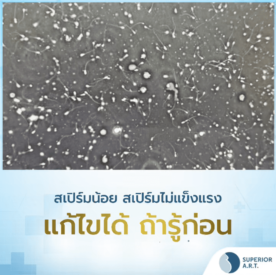 สเปิร์มน้อย สเปิร์มไม่แข็งแรง แก้ไขได้ ถ้ารู้ก่อน