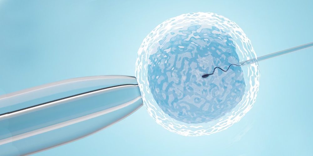 IVF/ICSI treatment