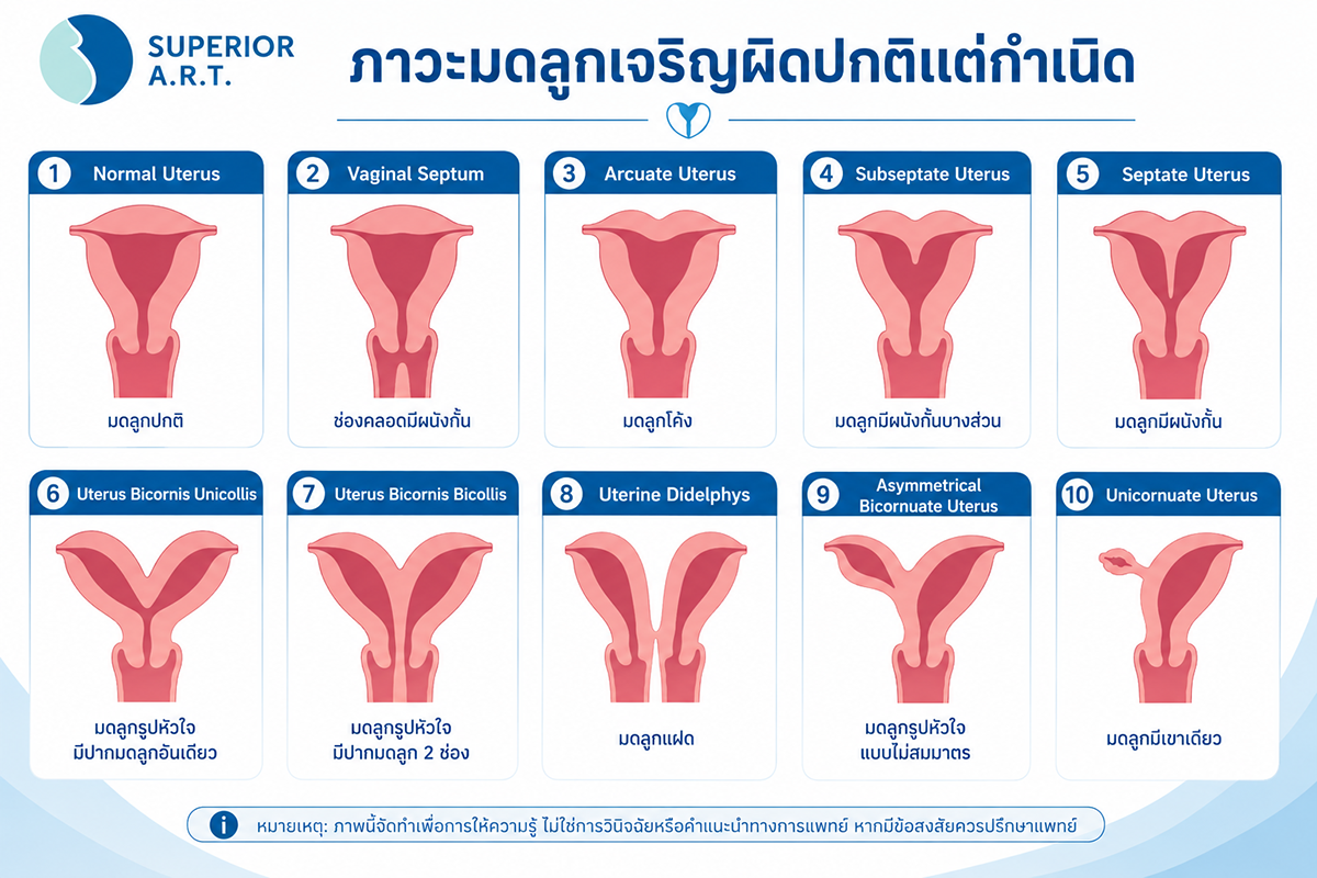 ปัญหามีลูกยาก ภาวะมดลูกเจริญผิดปกติแต่กำเนิด