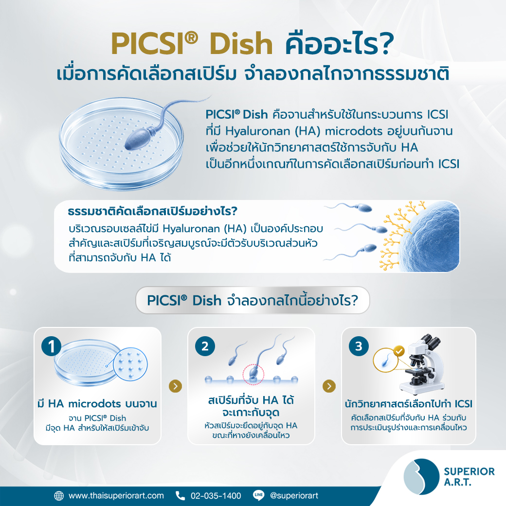 PICSI® Dish คืออะไร? อีกขั้นของการคัดเลือกอสุจิก่อนทำ ICSI